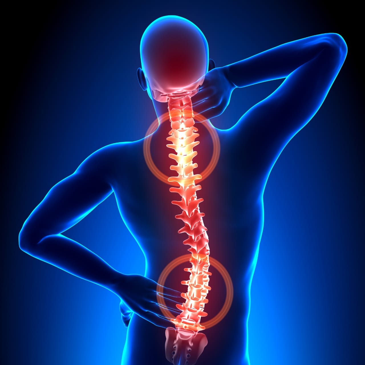 computerised image of backbone